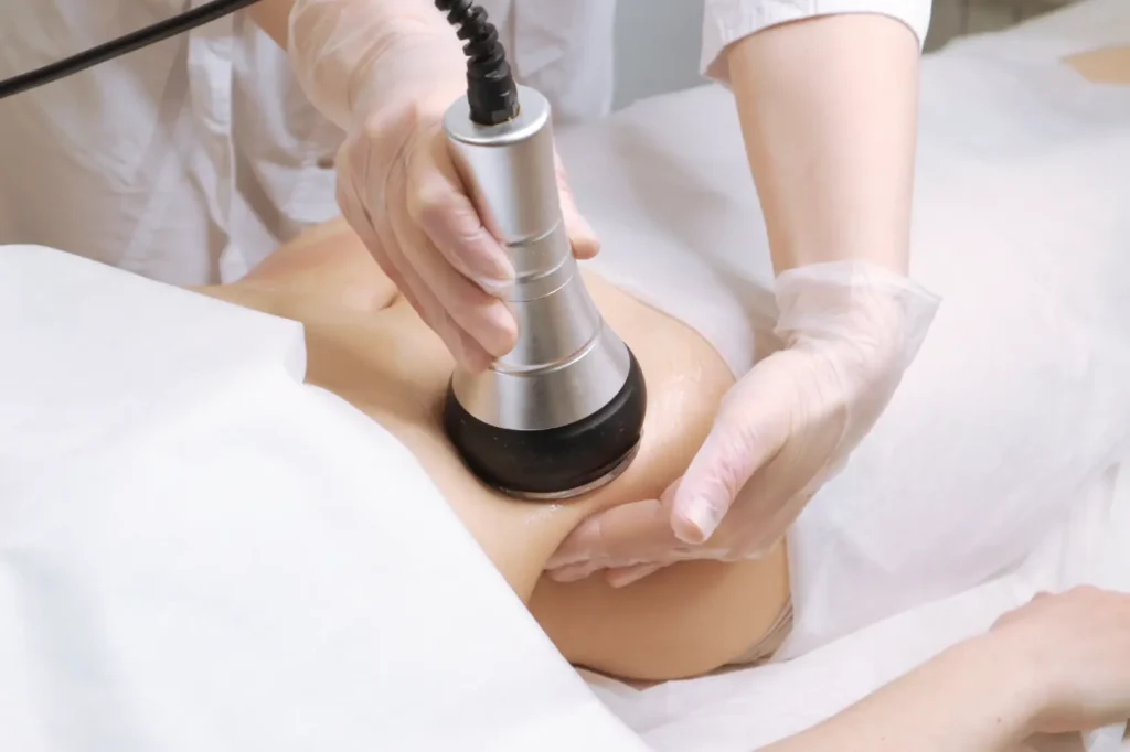 Device applied to abdomen during body contouring treatment