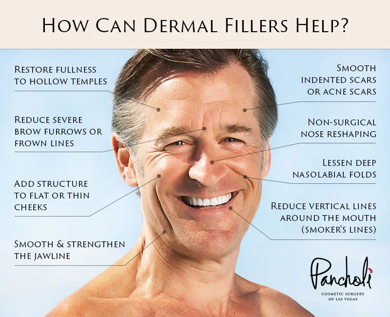 Men - How Can Dermal Fillers Help?