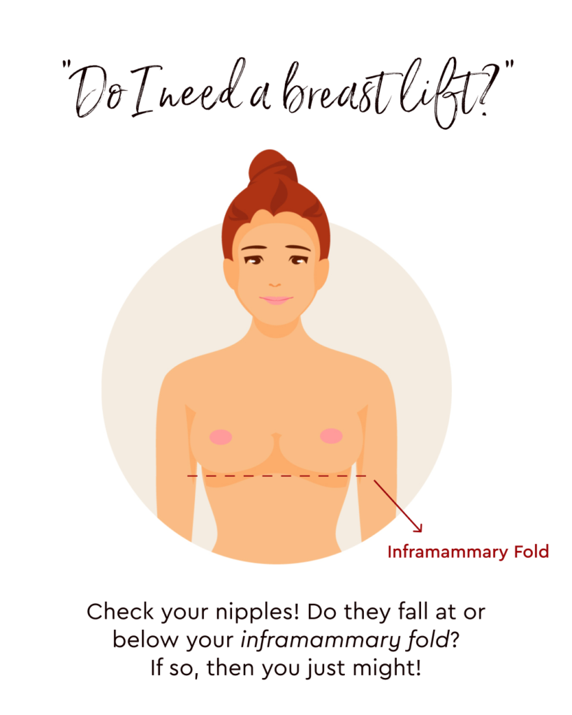 Do I need a breast lift? 