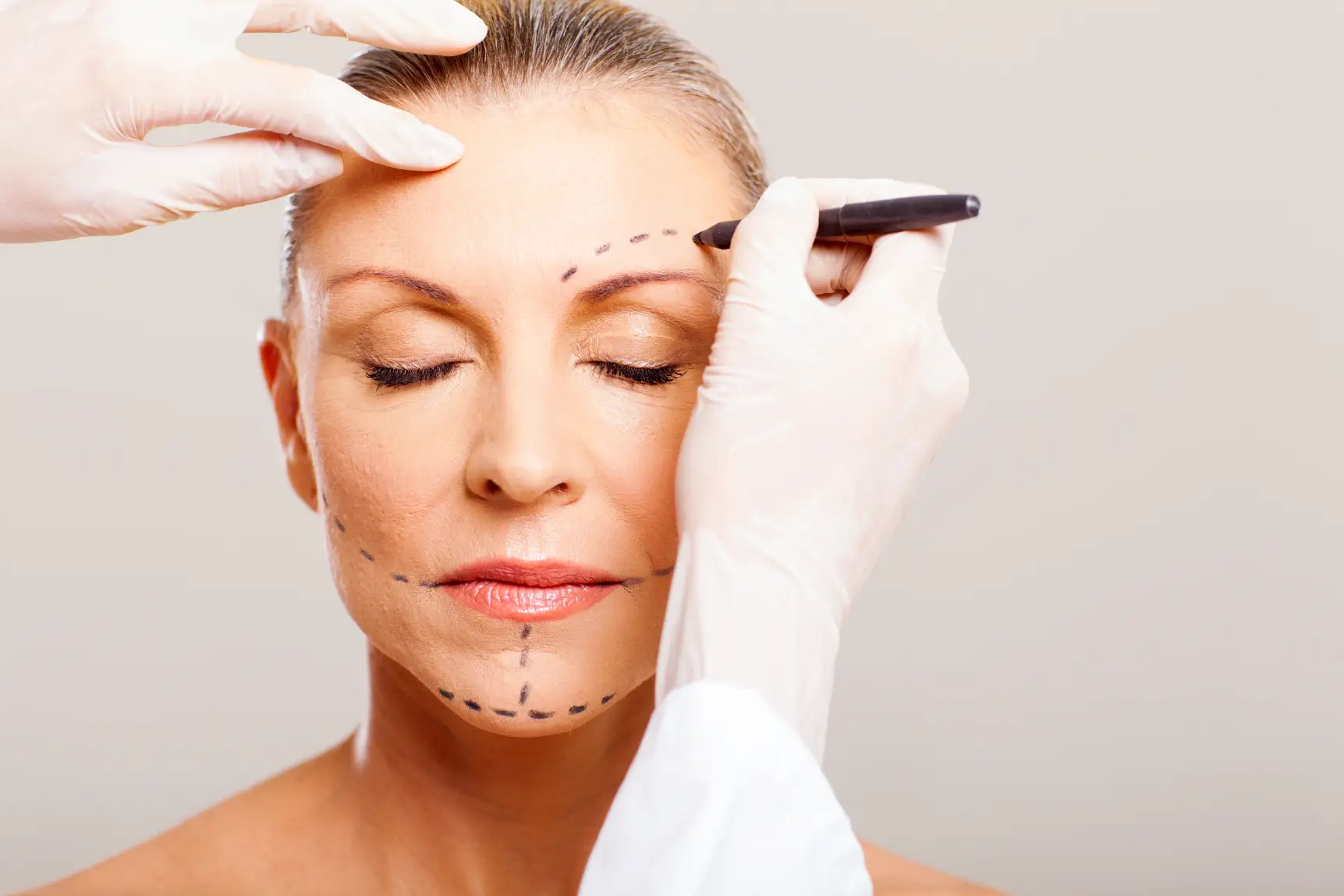 Practitioner marking lines on woman’s face before cosmetic surgery