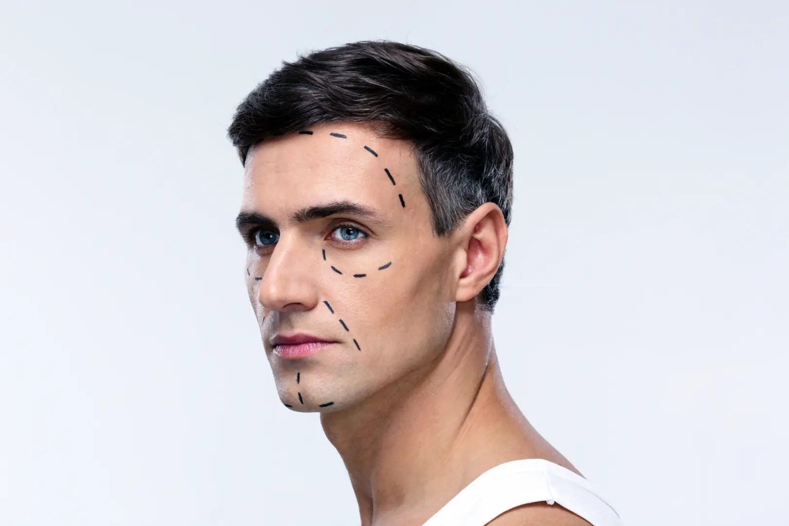 Male patient with facial surgery markings during consultation
