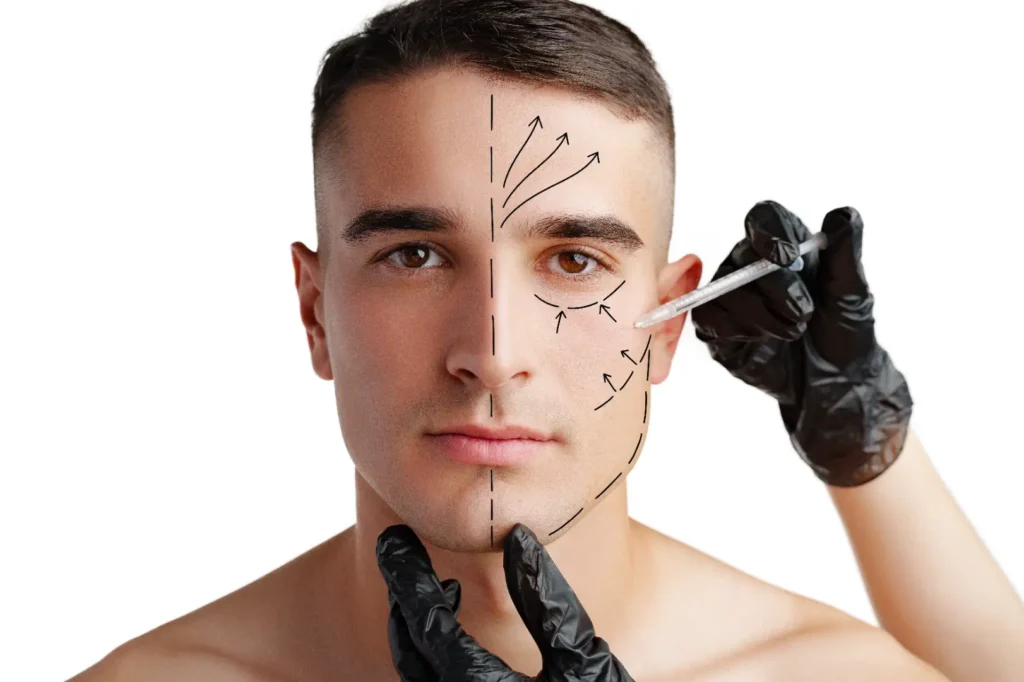 Man receiving facial injection consultation with treatment markings on face